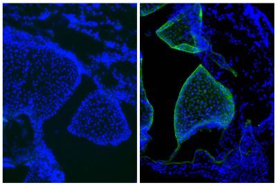 FITC Goat Anti-Mouse IgG1, Human Adsorbed | SouthernBiotech